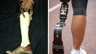 Prosthetics have come a long way since the early 1900's. Sources: Oddmonton & Nike